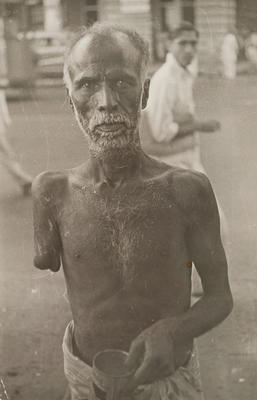 Bombay (beggar with amputated arm)